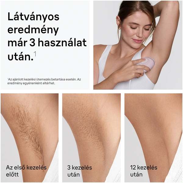 BRAUN Silk-Expert IPL PL1111 villanófényes szőrtelenítő