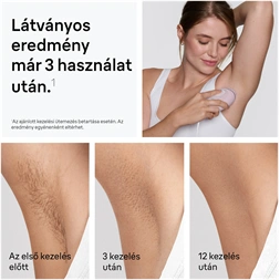 BRAUN Silk-Expert IPL PL1111 villanófényes szőrtelenítő
