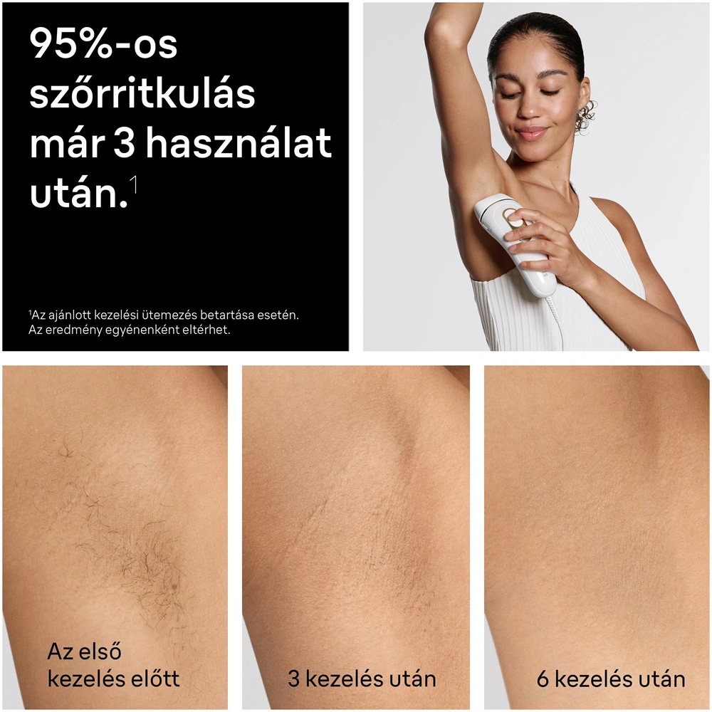 BRAUN Silk-Expert IPL PL5210 villanófényes szőrtelenítő
