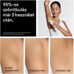 BRAUN Silk-Expert IPL PL5351 villanófényes szőrtelenítő