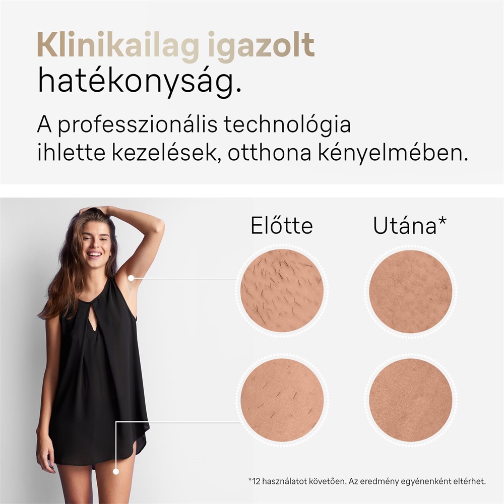 Braun Silk-expert Pro 5 PL5382 IPL villanófényes szőrtelenítő