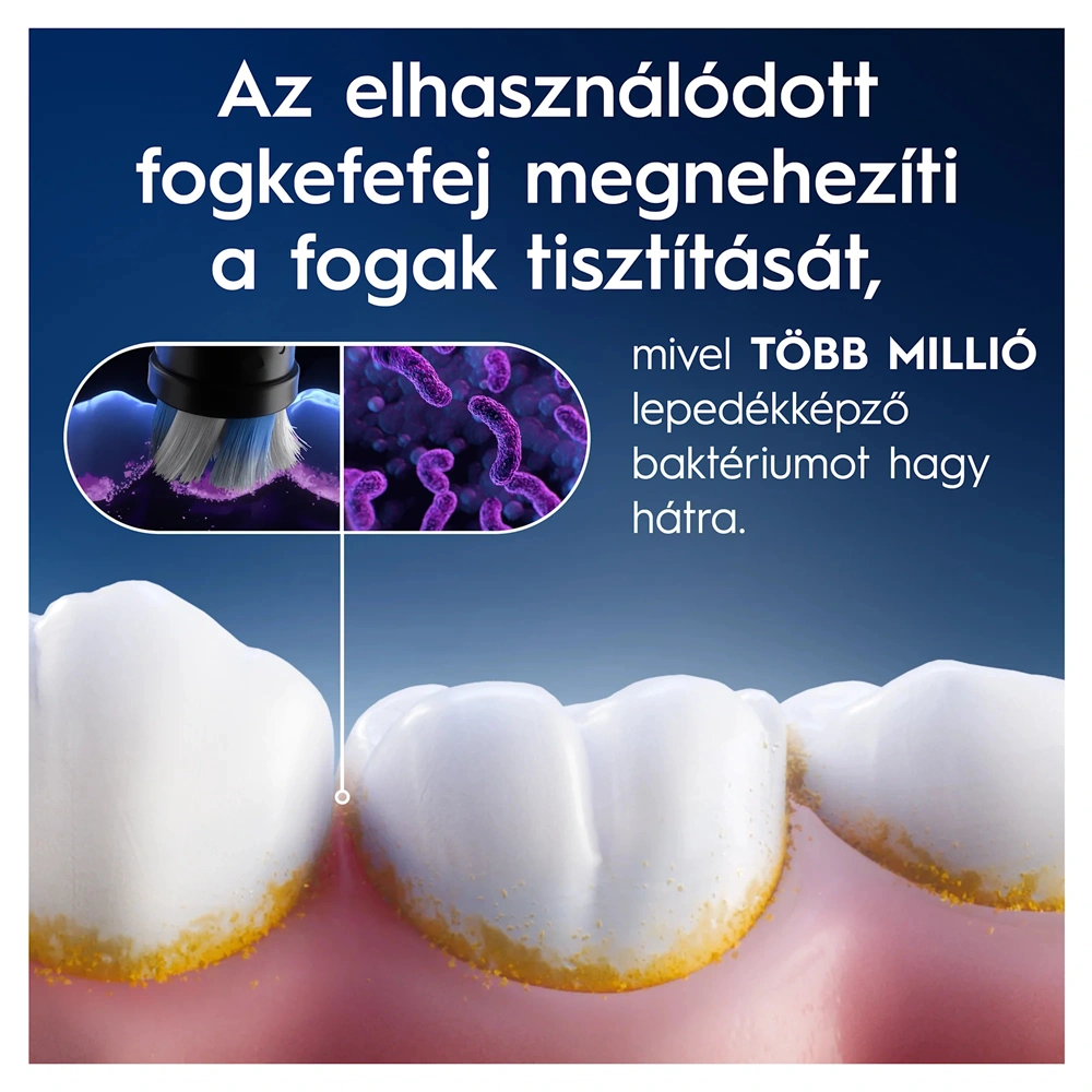 Oral-B iO Radiant White 4 db-os RB fogkefefej szett - új