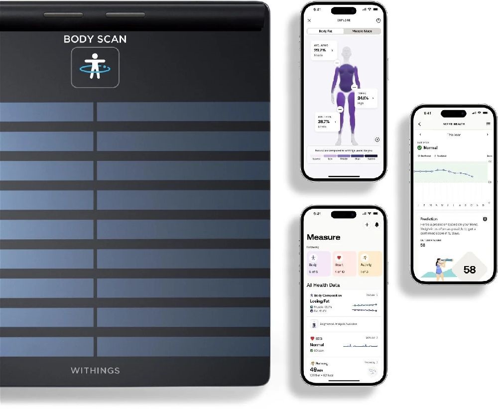 Withings Body Scan fekete személymérleg