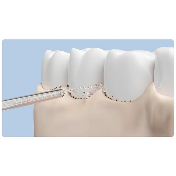 Xiaomi BHR9938GL Water Flosser Replacement Tips szájzuhany pótfej