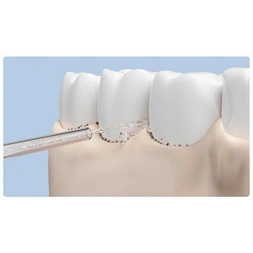 Xiaomi BHR9938GL Water Flosser Replacement Tips szájzuhany pótfej